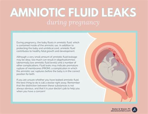 amniotic fluid sticky|Leaking amniotic fluid: Signs and what to do